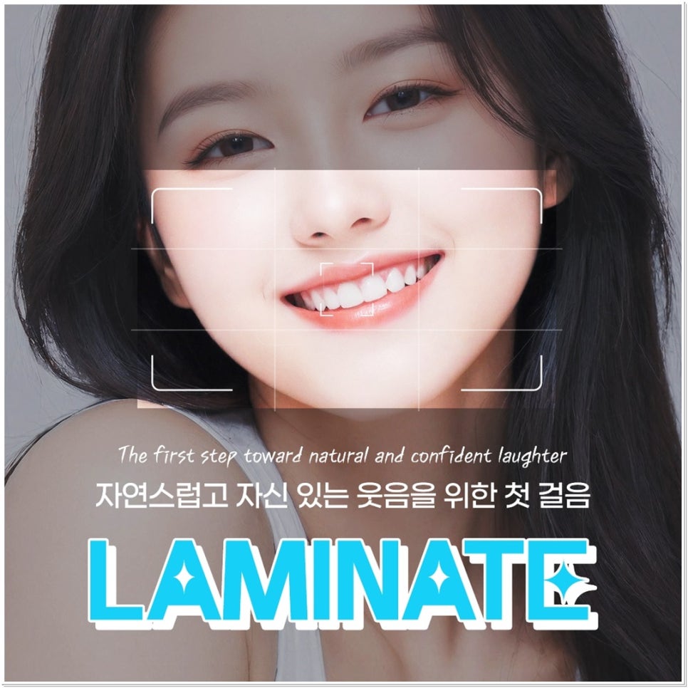 치아 변색 고민 끝, 을지로치과에서 듣는 라미네이트 사례 관련 이미지 2