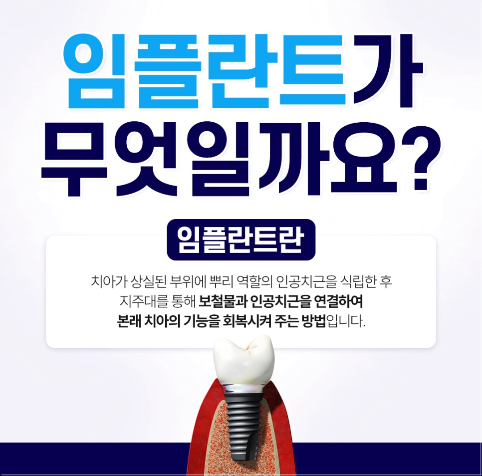 종로임플란트 건강한 치아를 위한 현명한 선택 관련 이미지 3