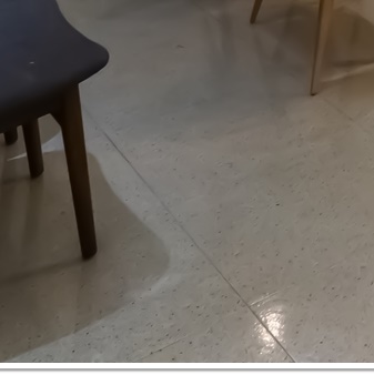 종각치과의 치아미백으로 하얀 미소 찾기 관련 이미지 32