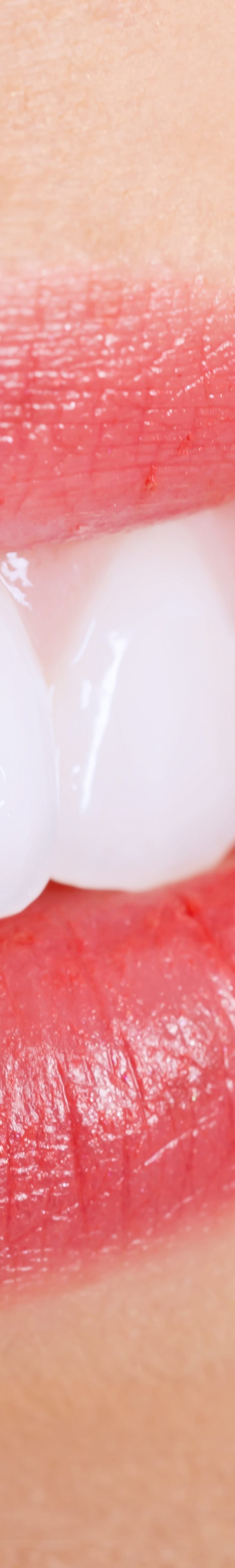 [종각역치과] 치아가 누렇게 보이는 진짜 이유, 미백 전에 꼭 알아야 할 것들 관련 이미지 15