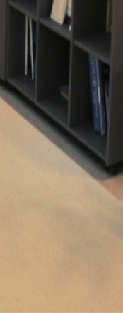 종로임플란트 이제는 걱정 말고 편안하게 관련 이미지 26