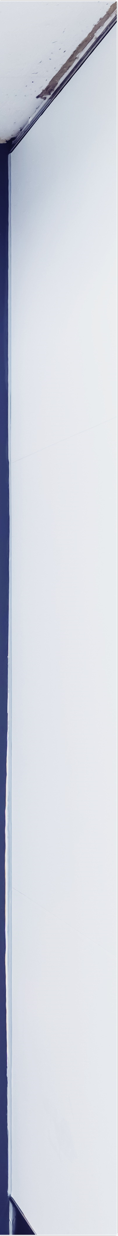 을지로치과 눈에띄지 않게 교정할 수 있는 방법 관련 이미지 25