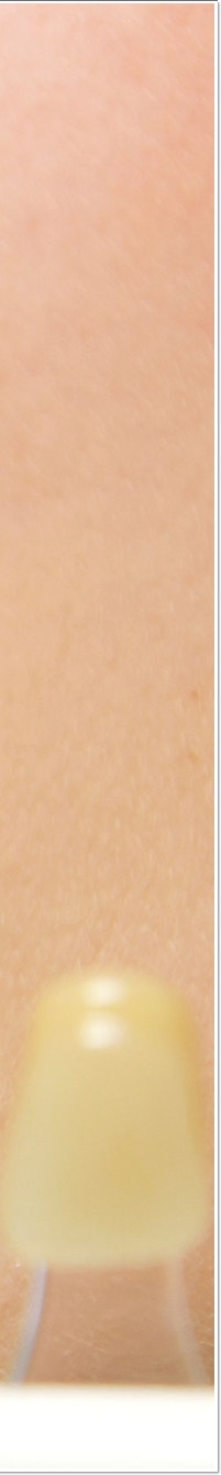 명동라미네이트, 단시간에 환한 미소를 가지고 싶다면? 관련 이미지 15