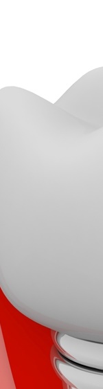 광화문치과 라미네이트 깨짐&middot;들뜸 원인과 예방 방법 완벽 정리 관련 이미지 9