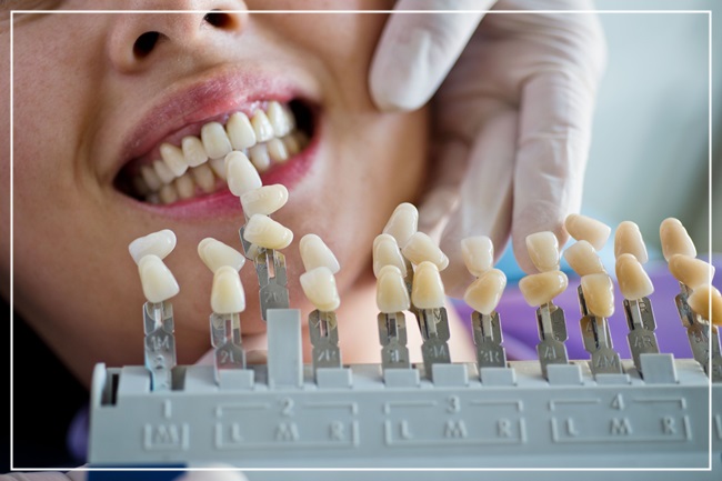 치아미백에 관한 모든 것! 관련 이미지 5