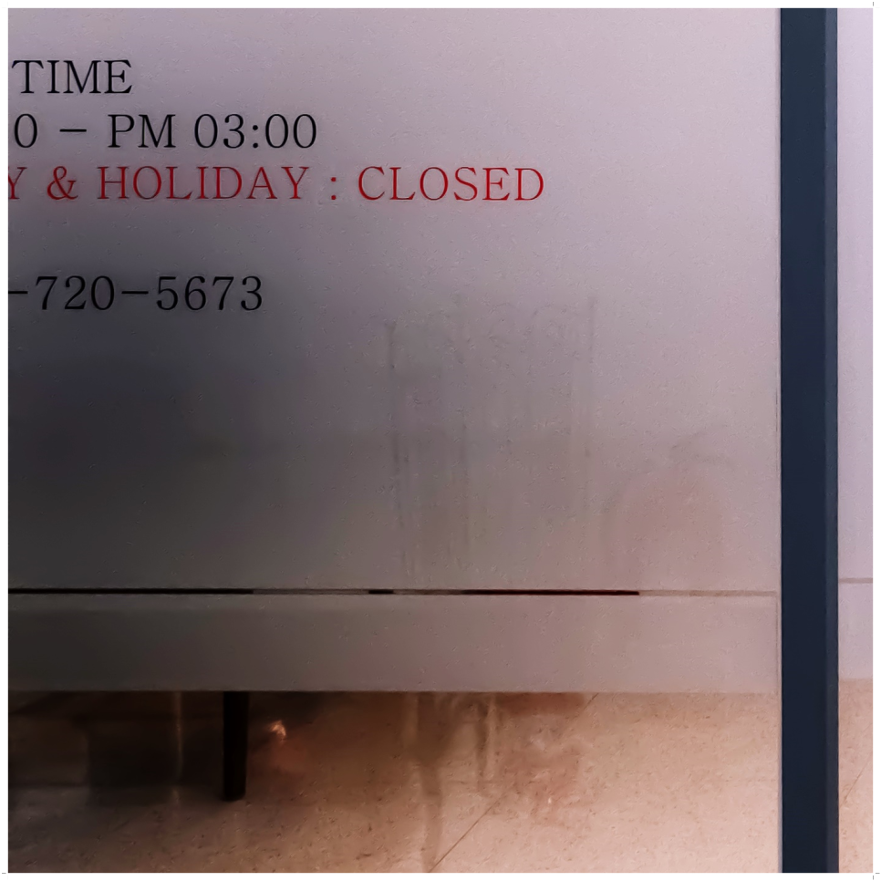 종로치과 마무리까지 확실하게 관련 이미지 25