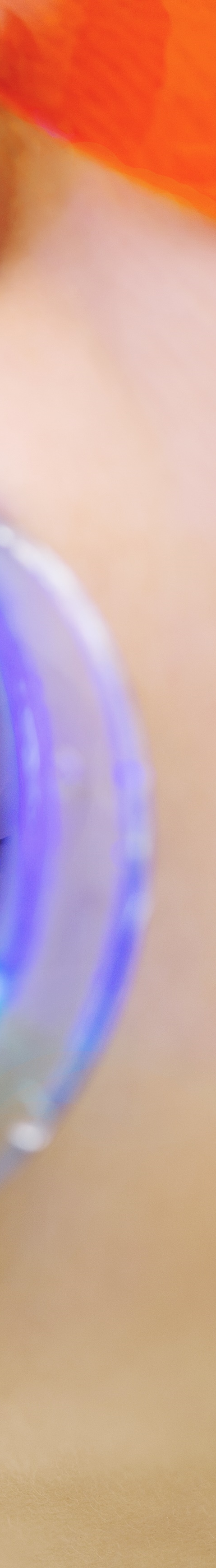 광화문역치과 치아미백과 라미네이트의 차이는? 관련 이미지 21