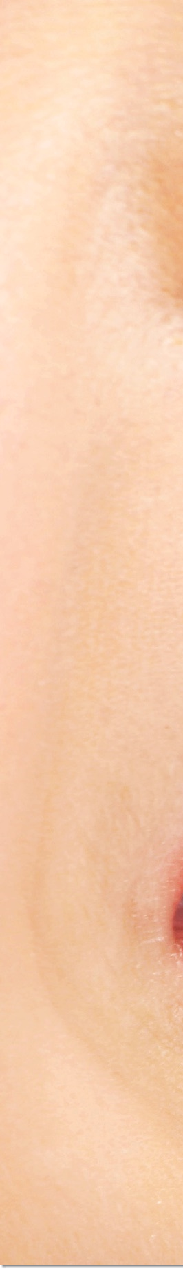 광화문역치과 라미네이트 치료가 궁금해요 관련 이미지 20