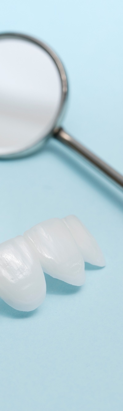 명동치과 주변 치아와 자연스러운 라미네이트 하는 방법 관련 이미지 9