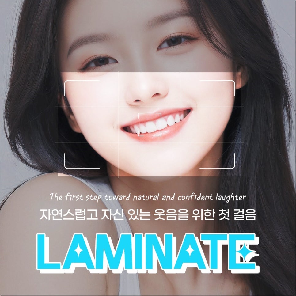 라미네이트, 어떤 경우에 필요할까? 종각역치과에서 알아보는 완벽 가이드 관련 이미지 1