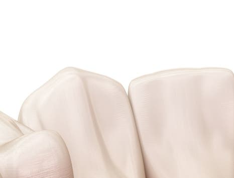 종각치과 너무 많은 치과 치료가 헷갈린다면? 관련 이미지 23