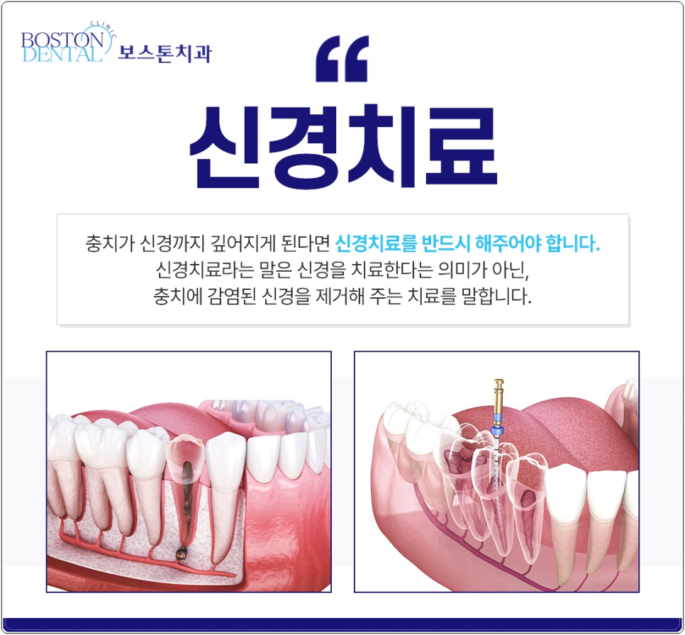 영어가능치과 친절하게 소통하고 정확하게 치료합니다. 관련 이미지 5