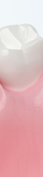 종로치과추천 나이별 &middot; 상황별 임플란트 치료 방법 관련 이미지 29