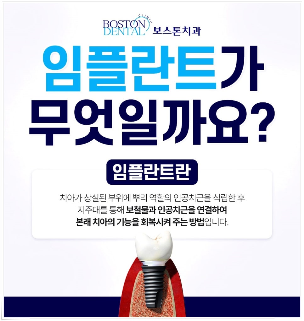 종로치과잘하는곳 임플란트 어떻게 진행이 되는 건가요? 관련 이미지 2