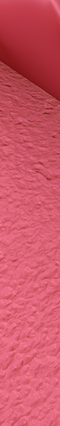 명동치과 주변 치아와 자연스러운 라미네이트 하는 방법 관련 이미지 21