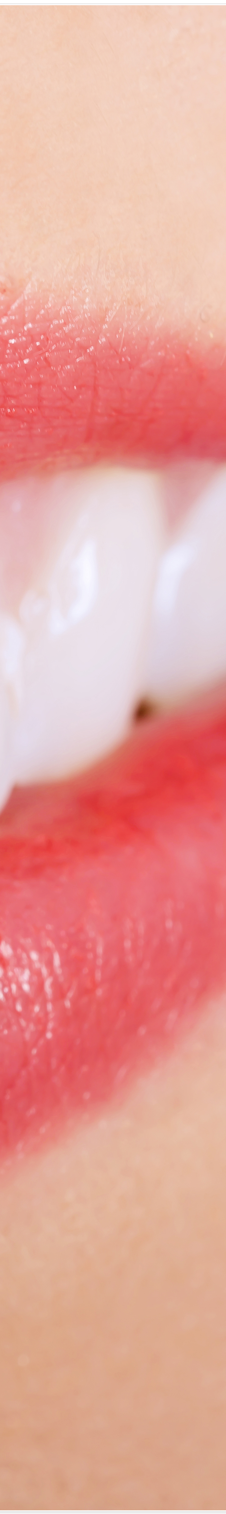 종로3가치과에서 알려드리는 무삭제 라미네이트 완벽 가이드 관련 이미지 17