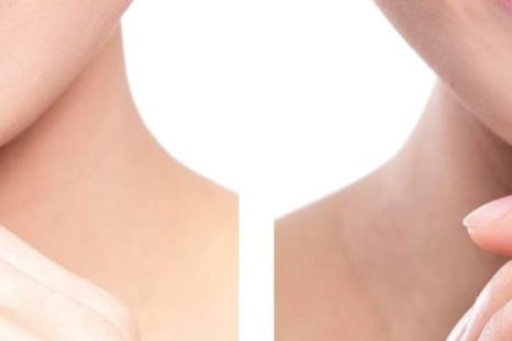 명동치과에서 알아보는 치아미백의 모든 것 관련 이미지 23