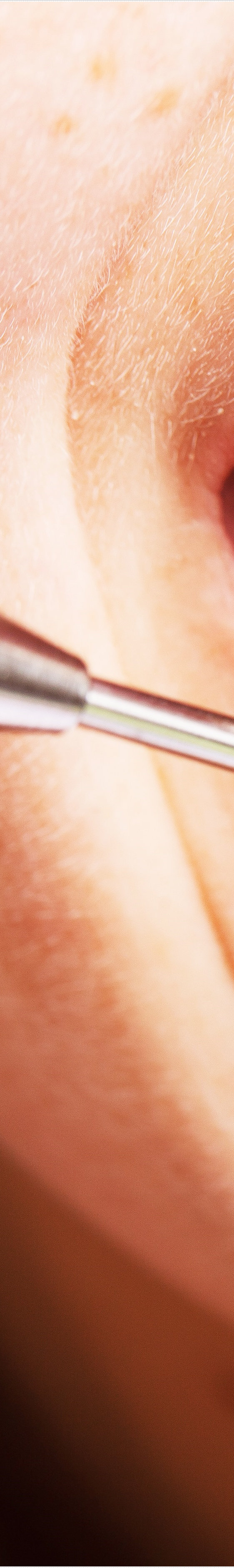 을지로입구역치과에서 알려드리는 치아미백과 라미네이트의 모든 것 관련 이미지 11