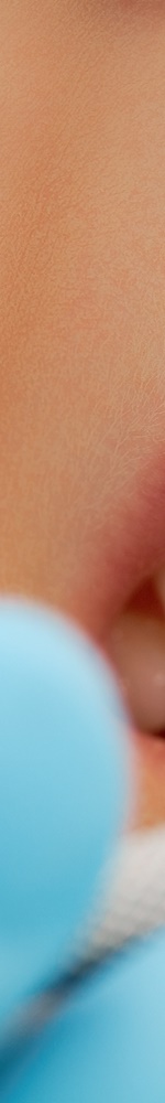 광화문치과 치아미백 그 후 관련 이미지 9