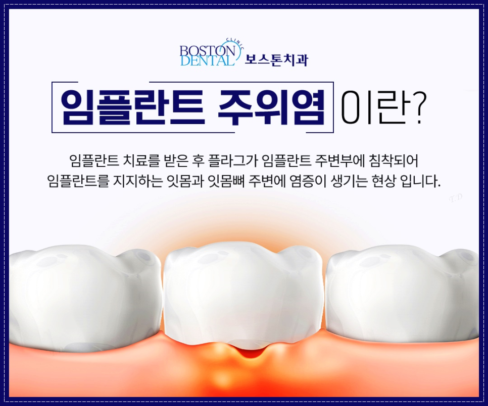 종각치과 정성스러운 진료로 안심을 드립니다. 관련 이미지 7