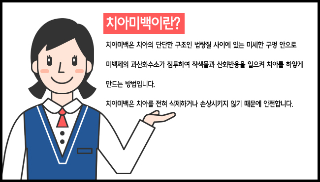 종각치아미백 빠른효과! 관련 이미지 2