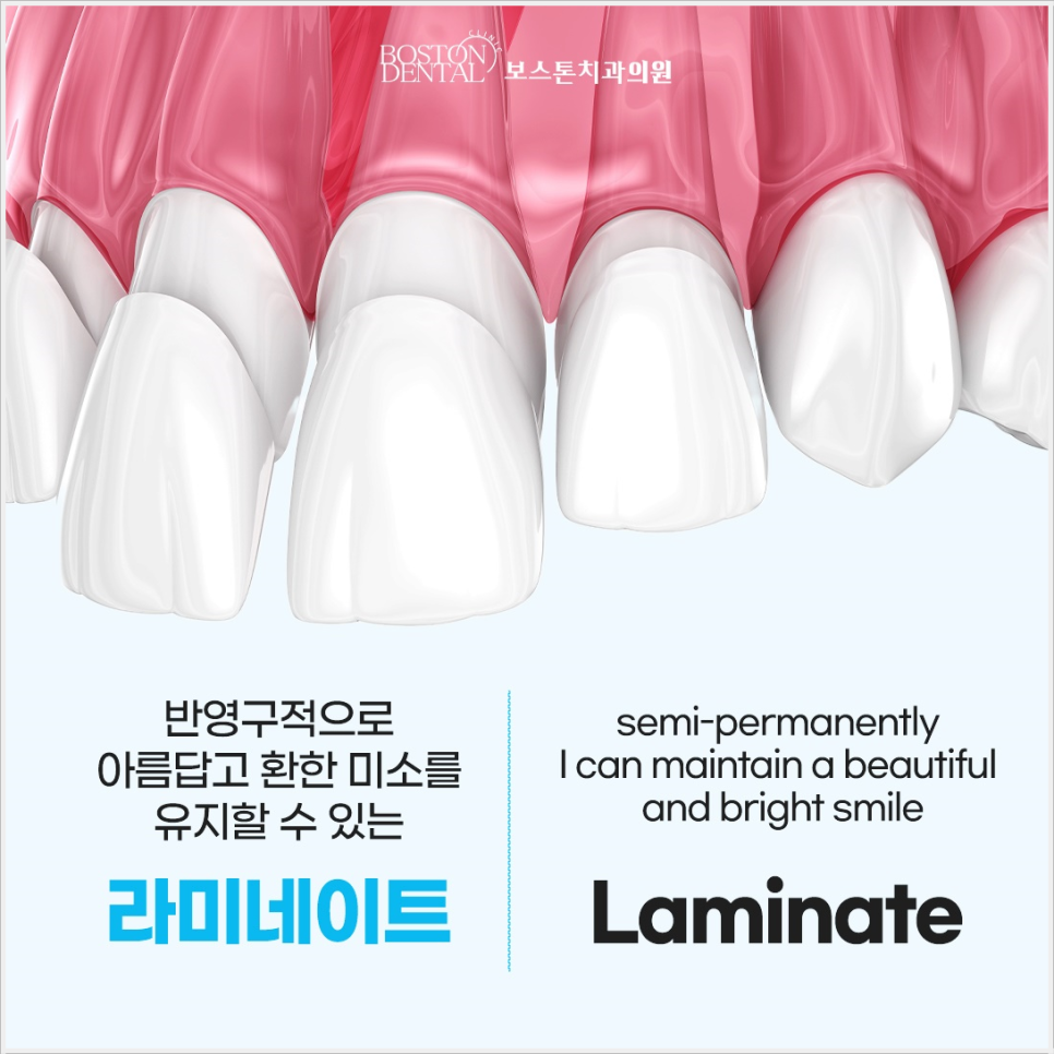 종로치과 자연스러운 미소 이제는 걱정없어요 관련 이미지 3