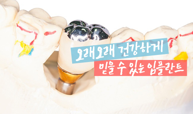 종각치과추천 사후관리까지 꼼꼼한곳 관련 이미지 3