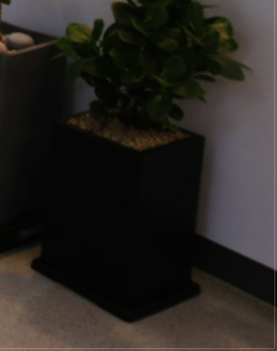 을지로치과 투명해서 티가 안 나게 교정할 수 있어요 관련 이미지 13