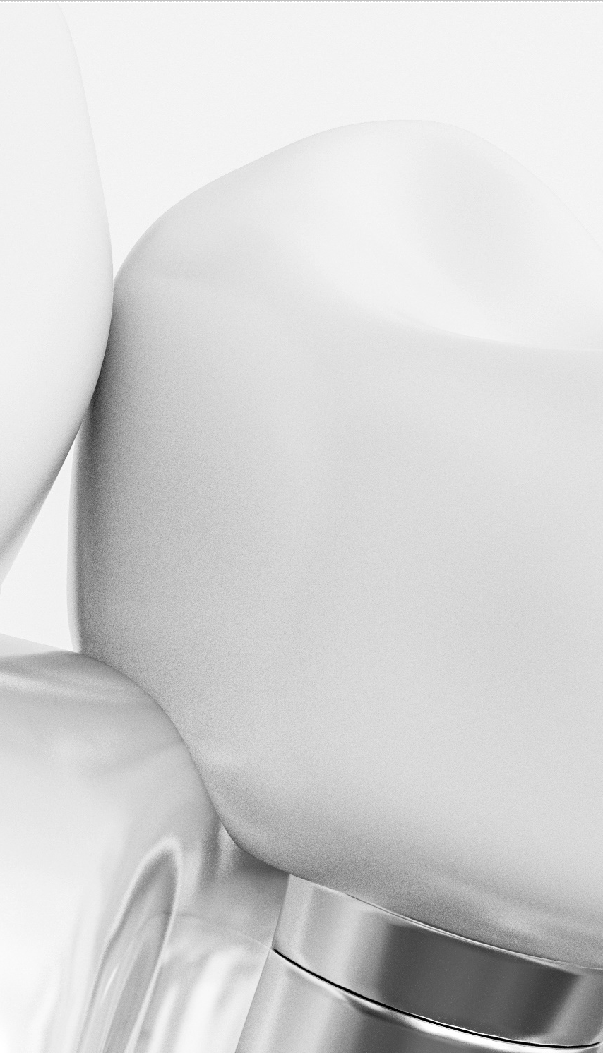 종각역치과 임플란트 치료, 이것만은 알고 계세요! 관련 이미지 26