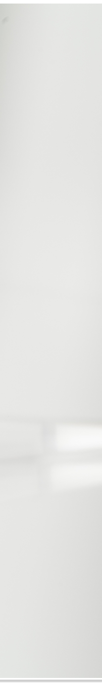 광화문역치과 치아미백과 라미네이트 나에게 필요한 건? 관련 이미지 27