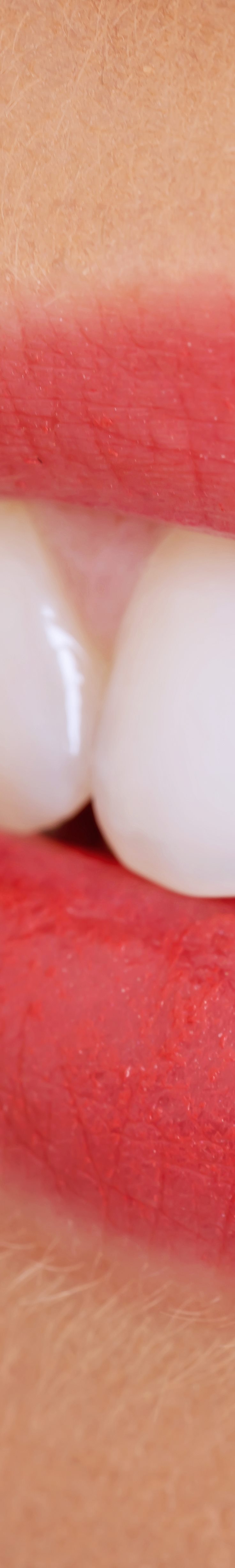 [종각역치과] 치아가 누렇게 보이는 진짜 이유, 미백 전에 꼭 알아야 할 것들 관련 이미지 11