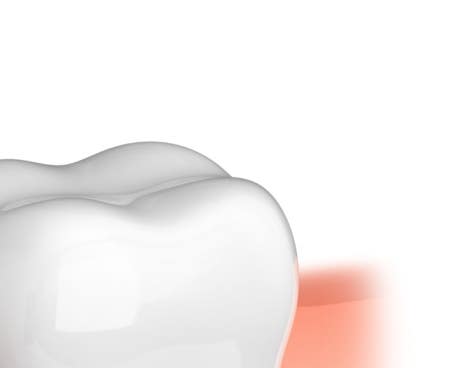 종각치과 너무 많은 치과 치료가 헷갈린다면? 관련 이미지 14