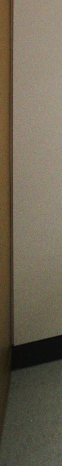 명동역치과 일상생활 중 치아가 흔들린다면 관련 이미지 17