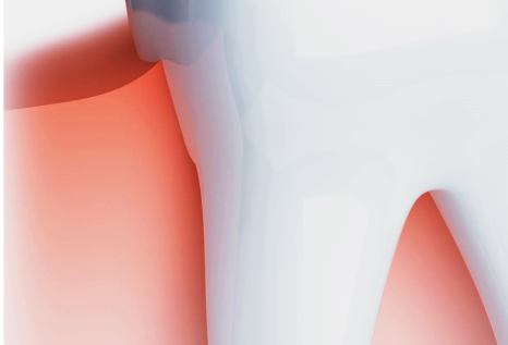 종로임플란트 건강한 치아를 위한 현명한 선택 관련 이미지 23