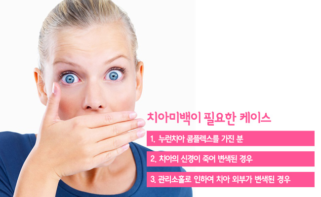 종각치아미백 빠른효과! 관련 이미지 5