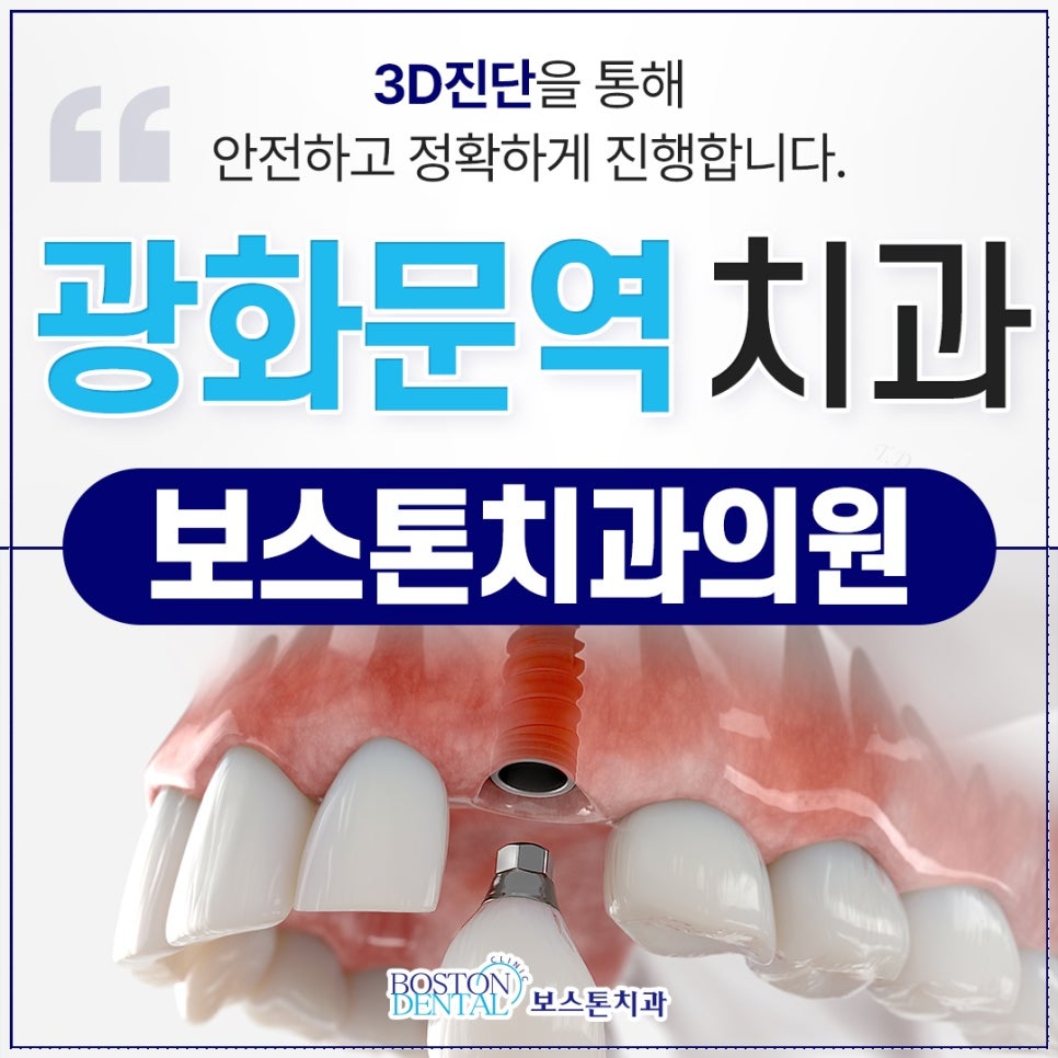 광화문역치과 상실된 치아를 치료하기 위한 방법들 관련 이미지 1