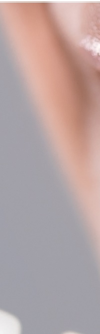 종로치과 라미네이트 주변 치아를 확인하여 자연스럽게 관련 이미지 10