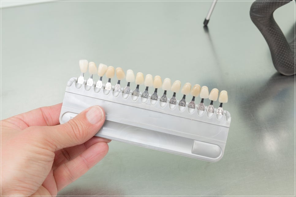 종로치과치료 커피&middot;와인 좋아해도 가능한 미백 유지 루틴 관련 이미지 7