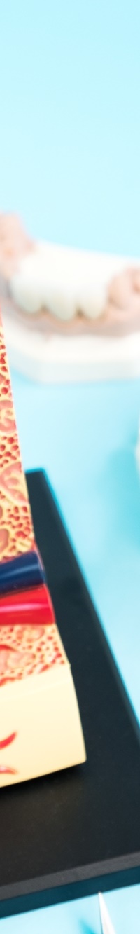 종각역치과 자연치아를 살리기 위한 대책, 신경치료 관련 이미지 31