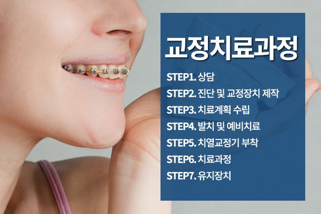청계천치과 치아교정 안심하고 시작! 관련 이미지 4