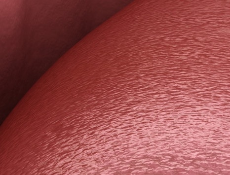 종각치과 너무 많은 치과 치료가 헷갈린다면? 관련 이미지 29