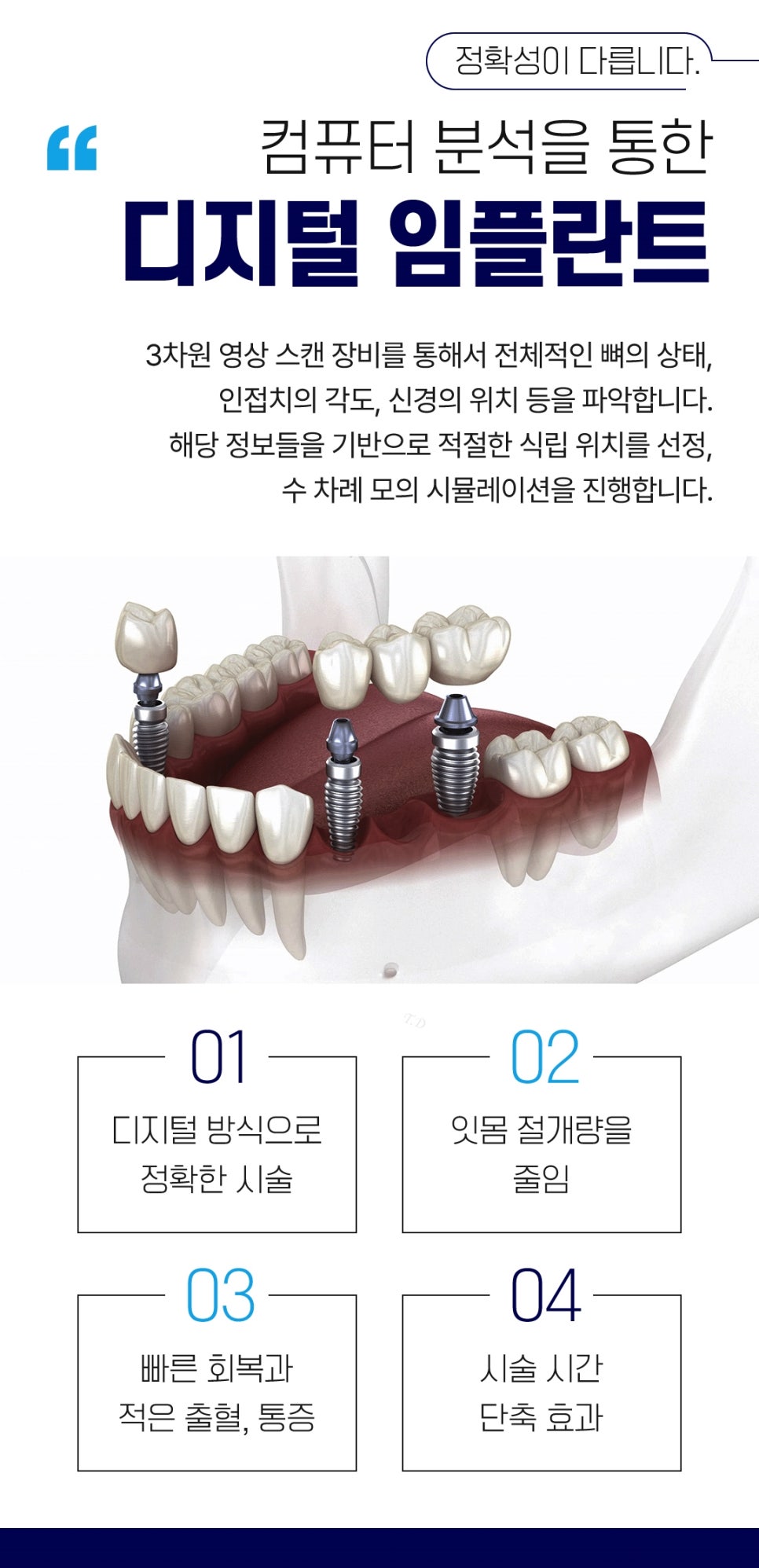 종각치과 임플란트 치료 후 관리 관련 이미지 4