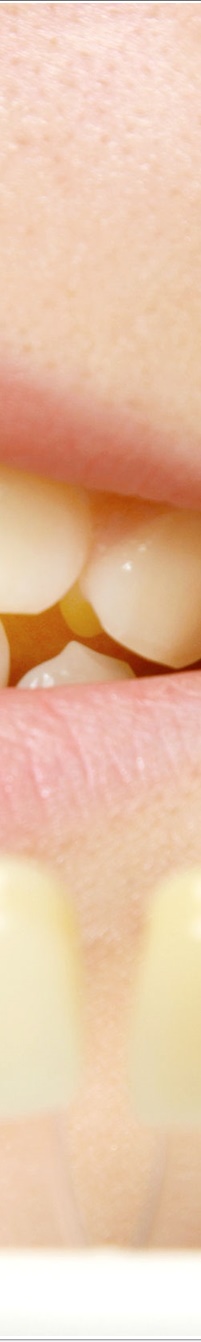 명동라미네이트, 단시간에 환한 미소를 가지고 싶다면? 관련 이미지 11