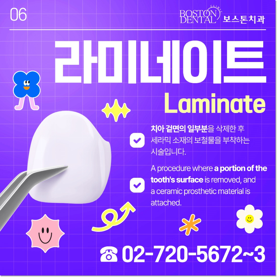 광화문역치과 라미네이트 치료가 궁금해요 관련 이미지 9