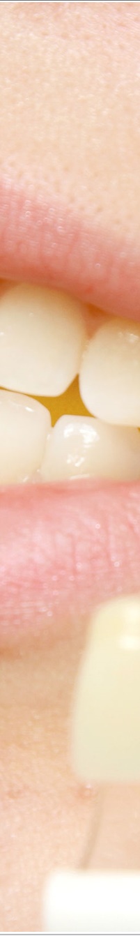 명동라미네이트, 단시간에 환한 미소를 가지고 싶다면? 관련 이미지 10