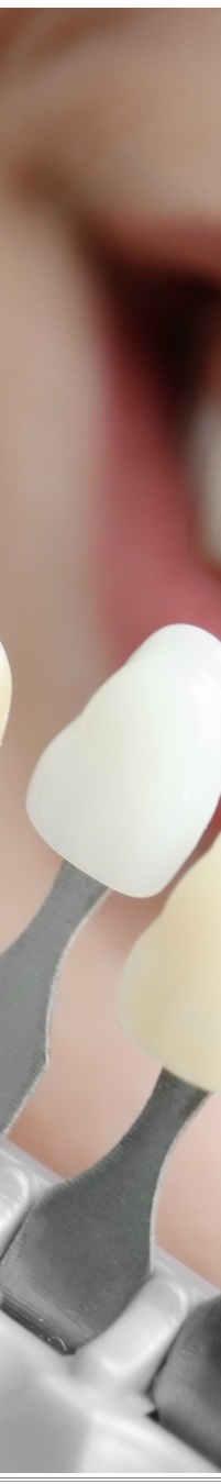 광화문역치과 생활습관에 따른 맞춤형 미백 관리 관련 이미지 29