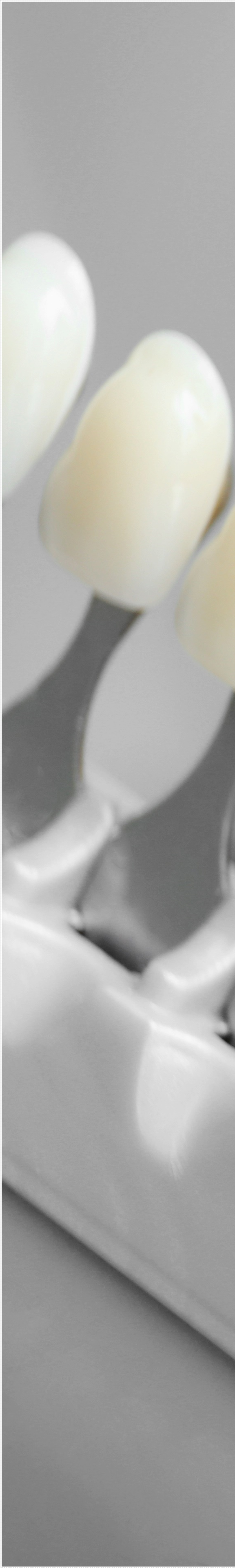 을지로입구역치과에서 알려드리는 치아미백과 라미네이트의 모든 것 관련 이미지 17