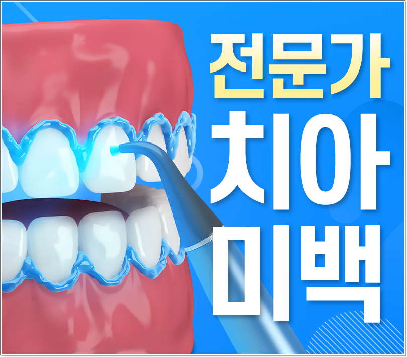 을지로치과 치아미백 후 관리 잘하고 계신가요? 관련 이미지 2