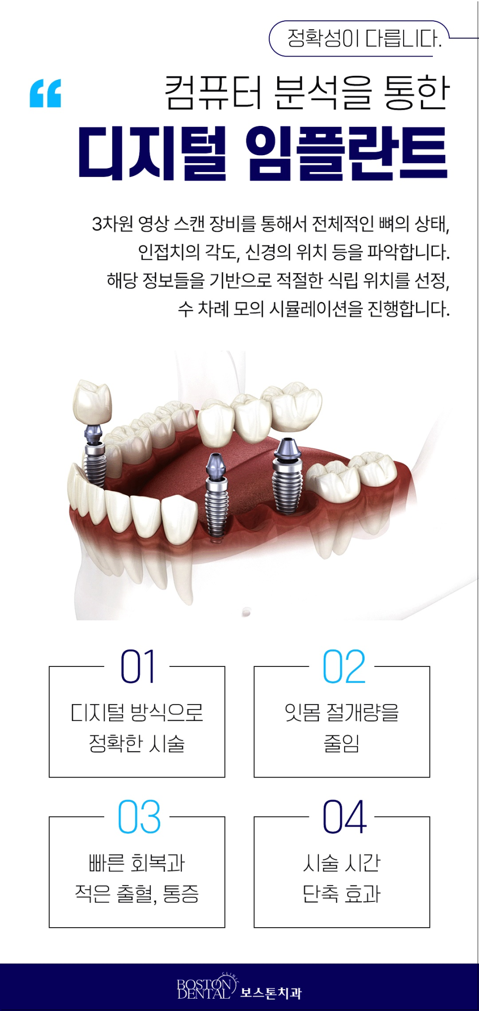 을지로치과 임플란트, 치아가 빠졌다면 어떻게 해야 할까요? 관련 이미지 5