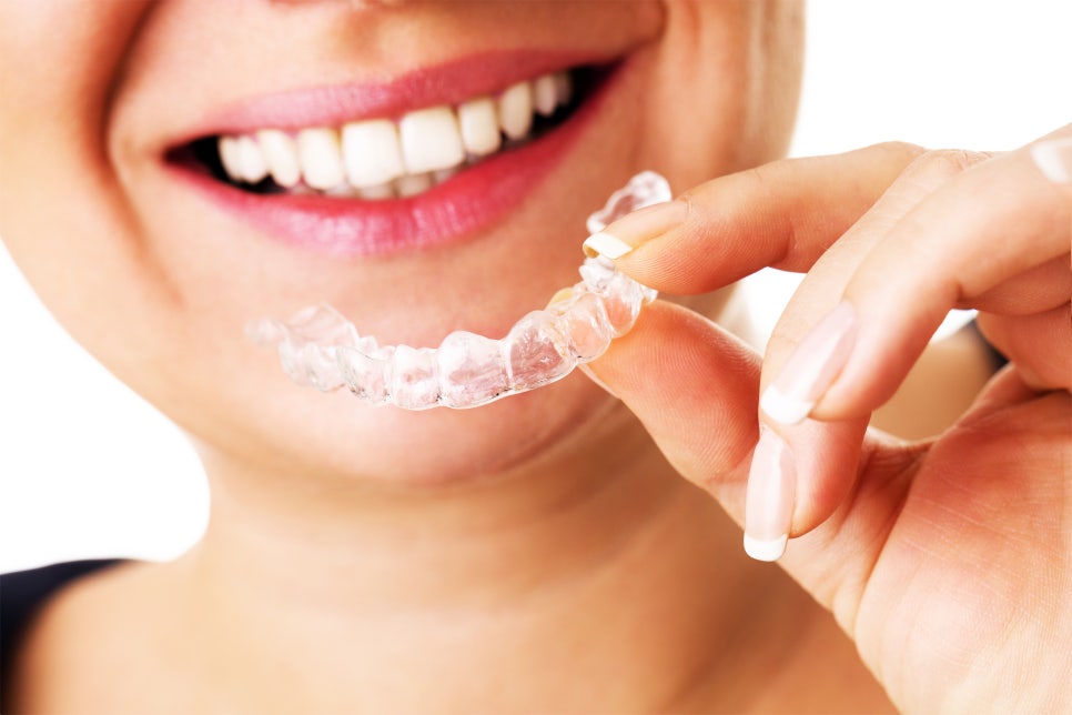 을지로치과에서 알려준 투명교정의 모든 것! 티 안 나게 교정하는 방법 완벽 가이드 관련 이미지 3